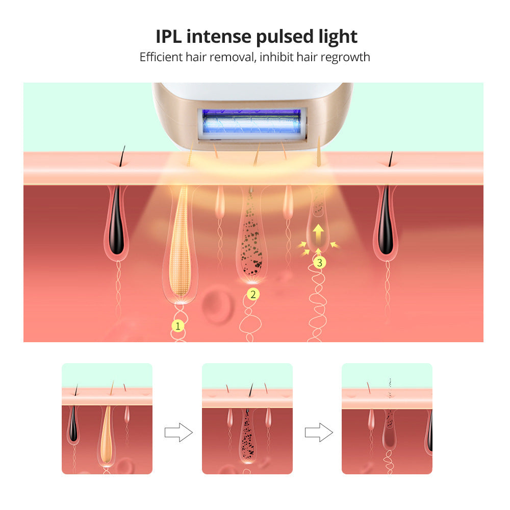 Screen 5-Speed Laser Hair Removal Device Ice-Sensing Home Full-Body Freezing Point Hair Removal Device IPL Photon Painless Hair Removal Device